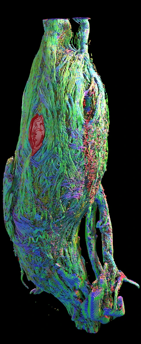 Three-dimensional reconstruction of a human nodose ganglion with colorful fibers, cells and vessels